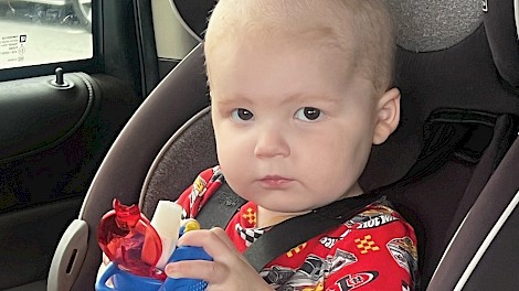 About three months into treatment during the consolidation phase, Bridger lost all his hair.